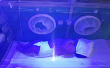 Завернули в одеяло и оставили на капоте: в Запорожье нашли новорожденного ребенка (ФОТО)