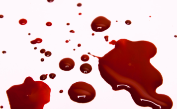 Оживленная трасса в Запорожской области залита кровью (ВИДЕО 18+)